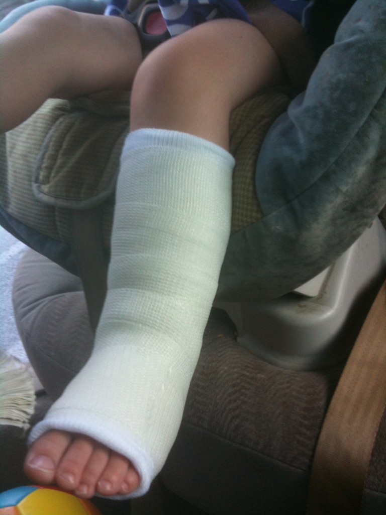 Baby s First Cast Tragic Sandwich